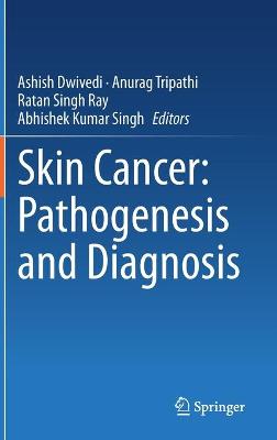 Skin Cancer: Pathogenesis and Diagnosis 2021 ed.