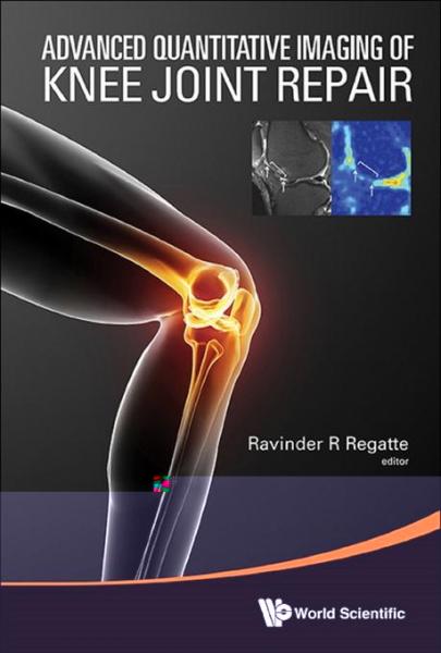 Advanced Quantitative Imaging Of Knee Joint Repair