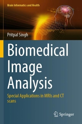 Biomedical Image Analysis: Special Applications in MRIs and CT scans