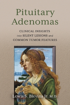 Pituitary Adenomas: Clinical Insights Into Silent Lesions and Common Tumor Features
