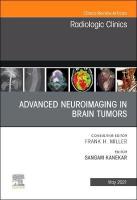 Advanced Neuroimaging in Brain Tumors, An Issue of Radiologic Clinics of  North America, Volume 59-3
