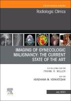 Imaging of Gynecologic Malignancy: The Current State of the Art, An Issue of  Radiologic Clinics of North America, Volume 61-4