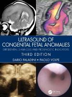Ultrasound of Congenital Fetal Anomalies: Differential Diagnosis and Prognostic Indicators 3rd edition