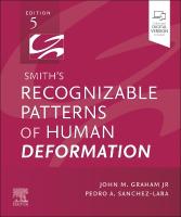 Smith's Recognizable Patterns of Human Deformation 5th edition