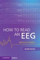 How to Read an EEG 2nd Revised edition