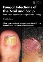 Fungal Infections of the Nail and Scalp: The Current Approach to Diagnosis and Therapy 3rd edition