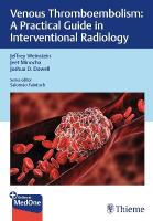 Venous Thromboembolism: A Practical Guide in Interventional Radiology New edition