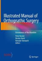Illustrated Manual of Orthognathic Surgery: Osteotomies of the Mandible 2024 ed.