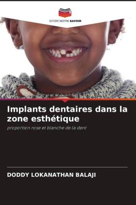 Implants dentaires dans la zone esthétique: proportion rose et blanche de la dent