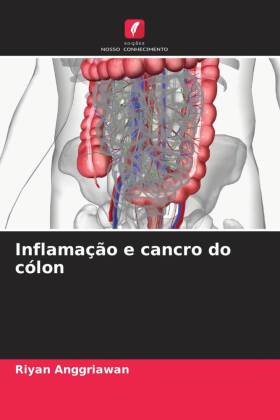 Inflamação e cancro do cólon