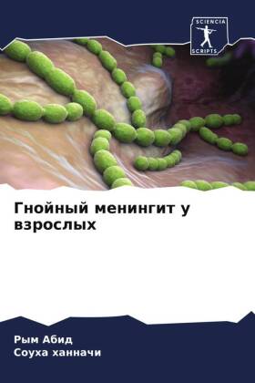 Gnojnyj meningit u wzroslyh